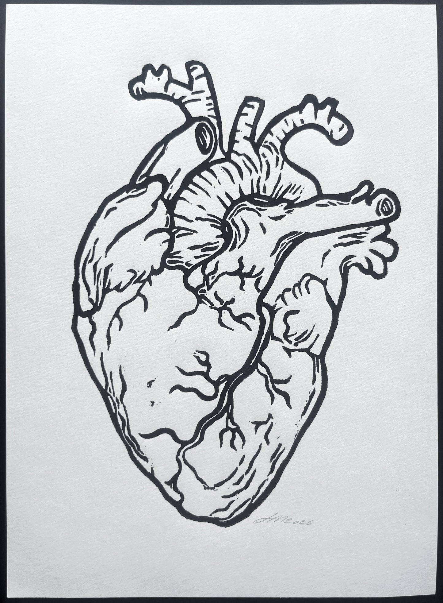 HJERTE