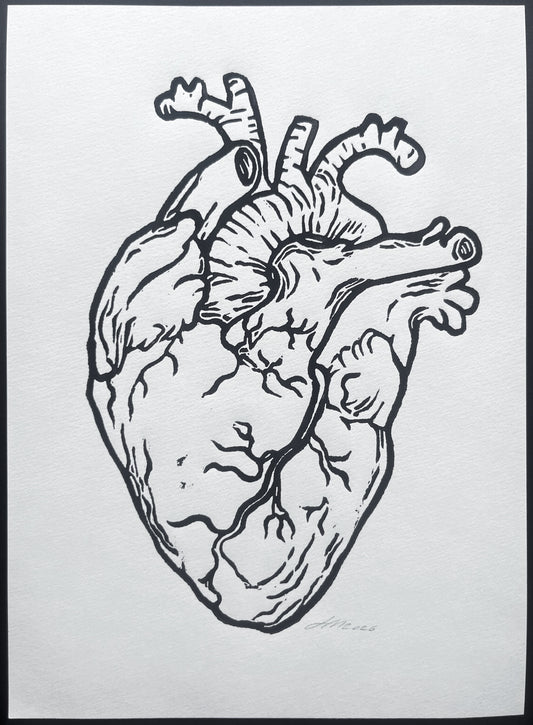 HJERTE